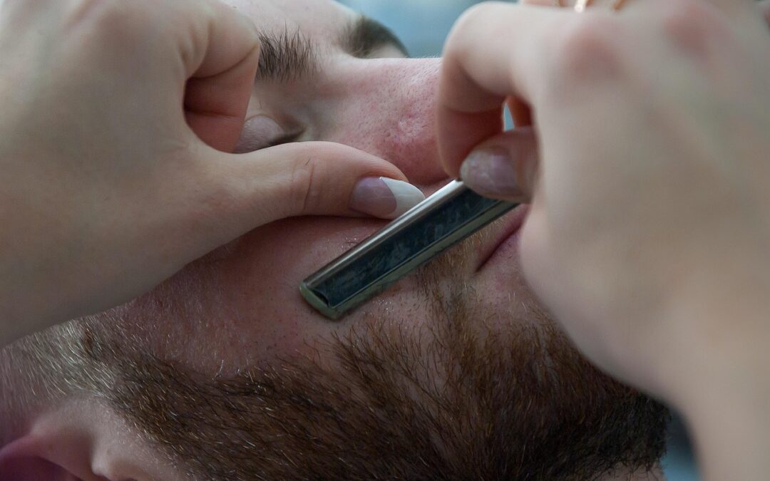 Baardschurft of: over de bijzondere behandeling van een schimmelinfectie in de baardstreek